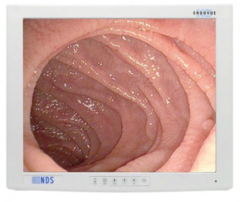 EndoVue 32"