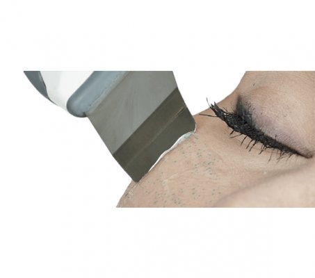 Ultrasound Face